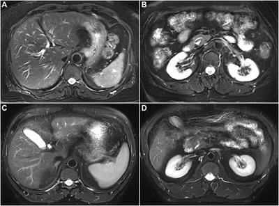 Feasibility of the application of frequency modulated continuous wave radar trigger technique in abdominal magnetic resonance imaging
